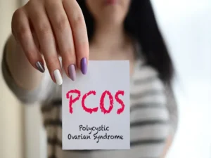 مدیریت PCOS