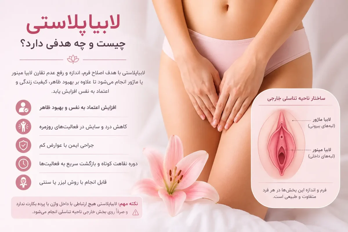 لابیاپلاستی