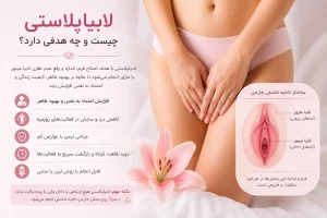 لابیاپلاستی